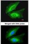 Transglutaminase 2 antibody, PA5-29357, Invitrogen Antibodies, Immunofluorescence image 