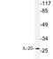 Interleukin 17B antibody, LS-C199904, Lifespan Biosciences, Western Blot image 