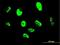 Snail Family Transcriptional Repressor 2 antibody, H00006591-M05, Novus Biologicals, Immunocytochemistry image 