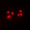 Core-Binding Factor Subunit Beta antibody, LS-C368668, Lifespan Biosciences, Immunofluorescence image 