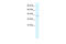 Regulating Synaptic Membrane Exocytosis 3 antibody, 28-178, ProSci, Western Blot image 