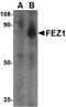 Fasciculation And Elongation Protein Zeta 1 antibody, orb74853, Biorbyt, Western Blot image 