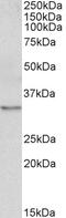 ATP Synthase Peripheral Stalk-Membrane Subunit B antibody, 43-547, ProSci, Western Blot image 