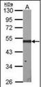 ERCC Excision Repair 8, CSA Ubiquitin Ligase Complex Subunit antibody, orb89371, Biorbyt, Western Blot image 