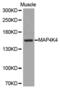 Mitogen-Activated Protein Kinase Kinase Kinase Kinase 4 antibody, abx002036, Abbexa, Western Blot image 