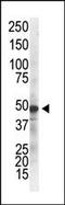 Inhibitor Of Nuclear Factor Kappa B Kinase Regulatory Subunit Gamma antibody, MA5-11179, Invitrogen Antibodies, Western Blot image 