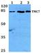 Transmembrane Channel Like 7 antibody, A14820, Boster Biological Technology, Western Blot image 