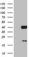 Galectin 9 antibody, LS-C339676, Lifespan Biosciences, Western Blot image 