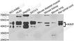 IKBKB Interacting Protein antibody, A7399, ABclonal Technology, Western Blot image 