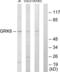 G Protein-Coupled Receptor Kinase 6 antibody, LS-C118894, Lifespan Biosciences, Western Blot image 