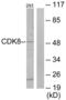 Cyclin Dependent Kinase 8 antibody, LS-C118905, Lifespan Biosciences, Western Blot image 