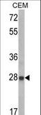 Insulin Like Growth Factor Binding Protein 6 antibody, LS-C165151, Lifespan Biosciences, Western Blot image 