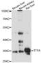 Alpha Tocopherol Transfer Protein antibody, LS-C749473, Lifespan Biosciences, Western Blot image 