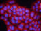 S100 Calcium Binding Protein A8 antibody, BAF3059, R&D Systems, Western Blot image 