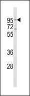 Transferrin Receptor antibody, 61-619, ProSci, Western Blot image 
