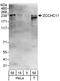 Terminal Uridylyl Transferase 4 antibody, A302-636A, Bethyl Labs, Western Blot image 