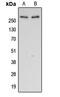 Filamin A antibody, LS-C353981, Lifespan Biosciences, Western Blot image 