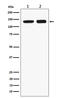 Ring Finger Protein 40 antibody, M06979-1, Boster Biological Technology, Western Blot image 