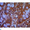Chromodomain Helicase DNA Binding Protein 3 antibody, LS-C814027, Lifespan Biosciences, Immunohistochemistry paraffin image 
