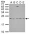 Interleukin 1 Receptor Antagonist antibody, LS-C185816, Lifespan Biosciences, Western Blot image 