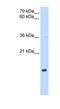 NADH:Ubiquinone Oxidoreductase Subunit B5 antibody, NBP1-59500, Novus Biologicals, Western Blot image 