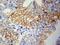 Vascular Cell Adhesion Molecule 1 antibody, LS-C192231, Lifespan Biosciences, Immunohistochemistry paraffin image 