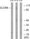 Chloride Voltage-Gated Channel 6 antibody, PA5-39101, Invitrogen Antibodies, Western Blot image 