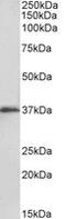 Musashi RNA Binding Protein 2 antibody, MBS423194, MyBioSource, Western Blot image 