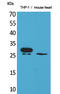 Triggering Receptor Expressed On Myeloid Cells 1 antibody, STJ96498, St John
