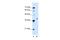 Homeobox D11 antibody, A10676, Boster Biological Technology, Western Blot image 