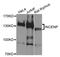Inner Centromere Protein antibody, A0622, ABclonal Technology, Western Blot image 