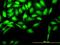 CDC28 Protein Kinase Regulatory Subunit 2 antibody, H00001164-M01, Novus Biologicals, Immunofluorescence image 
