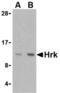 Harakiri, BCL2 Interacting Protein antibody, AHP1178T, Bio-Rad (formerly AbD Serotec) , Western Blot image 