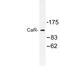 Calcium Sensing Receptor antibody, LS-C176584, Lifespan Biosciences, Western Blot image 