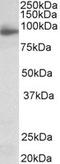 Neuroligin 4 X-Linked antibody, MBS422942, MyBioSource, Western Blot image 