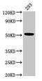 Tubulin Beta 3 Class III antibody, CSB-PA03879A0Rb, Cusabio, Western Blot image 