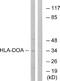 Major Histocompatibility Complex, Class II, DO Alpha antibody, A30721, Boster Biological Technology, Western Blot image 