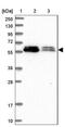 ALG10 Alpha-1,2-Glucosyltransferase antibody, NBP2-14281, Novus Biologicals, Western Blot image 