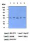 C-Reactive Protein antibody, GTX53706, GeneTex, Western Blot image 