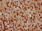 Homeodomain Interacting Protein Kinase 2 antibody, LS-C682296, Lifespan Biosciences, Immunohistochemistry paraffin image 