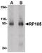 CD180 Molecule antibody, PA5-20250, Invitrogen Antibodies, Western Blot image 