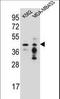 Phosphate Cytidylyltransferase 1, Choline, Alpha antibody, LS-C163456, Lifespan Biosciences, Western Blot image 