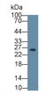 Deoxythymidylate Kinase antibody, LS-C663942, Lifespan Biosciences, Western Blot image 
