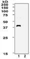 XPA, DNA Damage Recognition And Repair Factor antibody, GTX00704, GeneTex, Western Blot image 