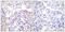 SRBP1 antibody, LS-C198595, Lifespan Biosciences, Immunohistochemistry paraffin image 