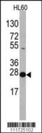 Eukaryotic Translation Initiation Factor 4E antibody, 60-600, ProSci, Western Blot image 