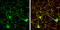 Protein Phosphatase 3 Regulatory Subunit B, Alpha antibody, GTX114181, GeneTex, Immunofluorescence image 