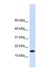 Pleckstrin Homology Like Domain Family A Member 3 antibody, NBP1-56772, Novus Biologicals, Western Blot image 