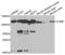 Cartilage Oligomeric Matrix Protein antibody, LS-B13394, Lifespan Biosciences, Western Blot image 