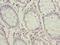 Protein ZNF767 antibody, A65410-100, Epigentek, Immunohistochemistry paraffin image 